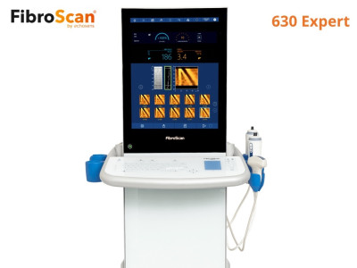 FibroScan® Expert 630: Інноваційний стандарт діагностики печінки для сучасної клініки